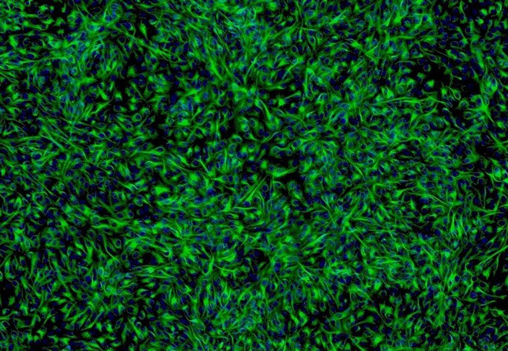 ScienCell's Human Retinal Pigment Epithelial Cells (HRPEpiC) - Immunostaining for CK-18, 200x.