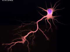 Rat Neurons-hippocampal #R1540