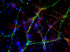 Day 9 post-embedding: Endothelial cells stained with VWF (green) and pericytes stained with NG2 (red), 200x