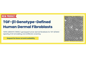 TGFB1 rs1800470-Genotyped Human Dermal Fibroblasts