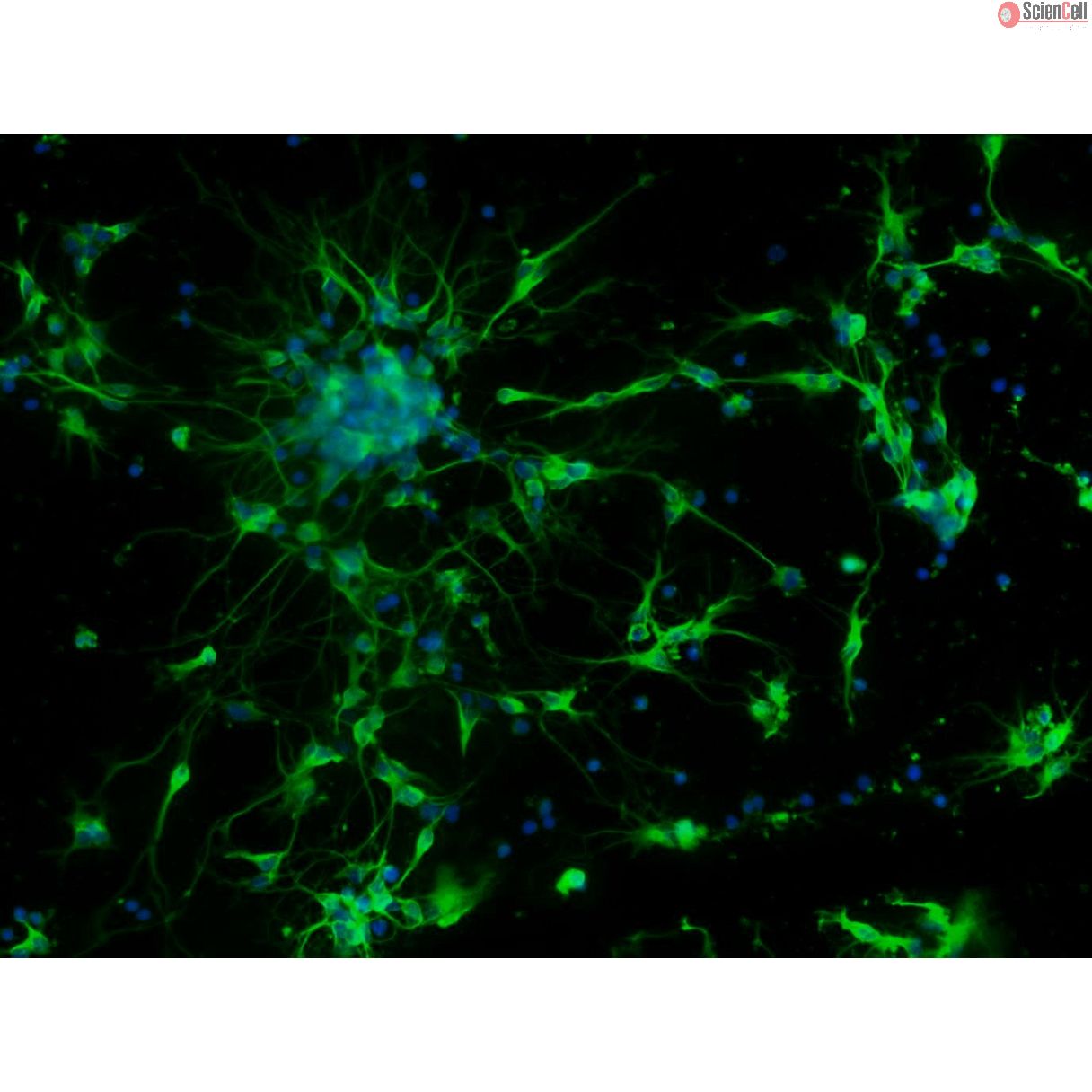 Mouse Neurons-forebrain (MN-fb)