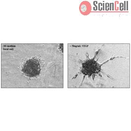 3D-Angiogenesis Assay (3D-AA)