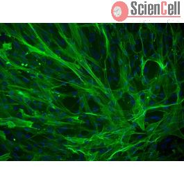 Human Bladder Smooth Muscle Cells, Primary (HBSMC) - CellSystems®
