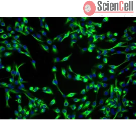 Human Lens Epithelial Cells | Sciencell