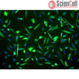 Human Mammary Epithelial Cells (HMEpiC) | Sciencell