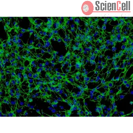 human-pulmonary-artery-