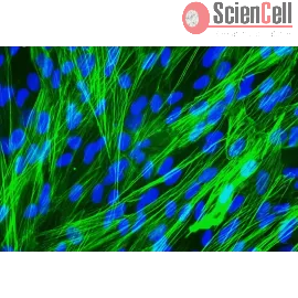 Pasmc Human Pulmonary Artery Smooth Muscle Cells (HPASMC)