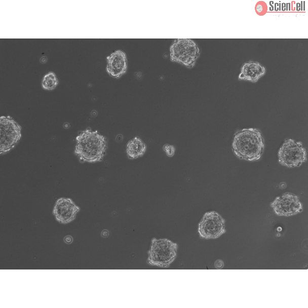 3D hepatic stellate cell spheroids at day 2
