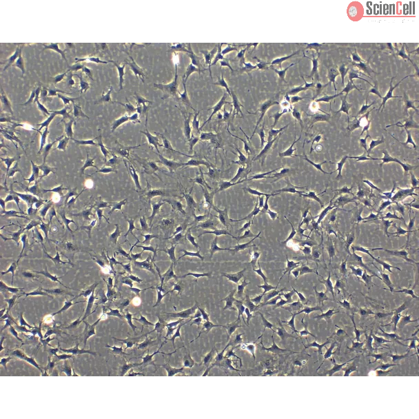 Phase Contrast Caption: Bovine Astrocytes (BA)- Phase Contrast, 100x

