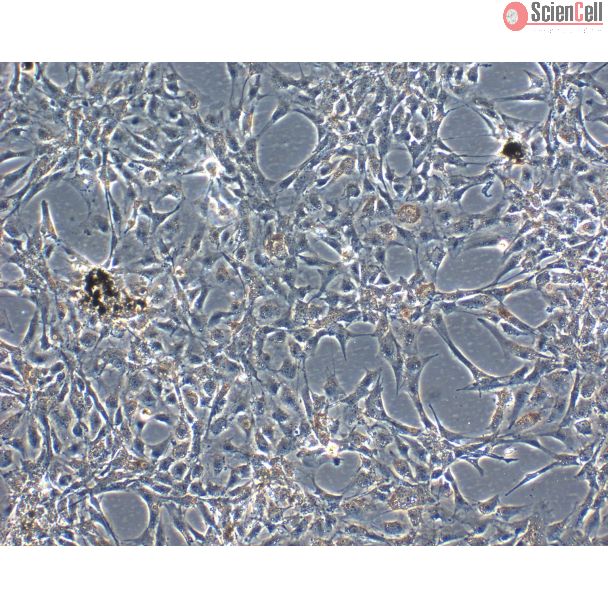 Bovine Iris Pigment Epithelial Cells (BIPEpiC)-Phase Contrast, 100X