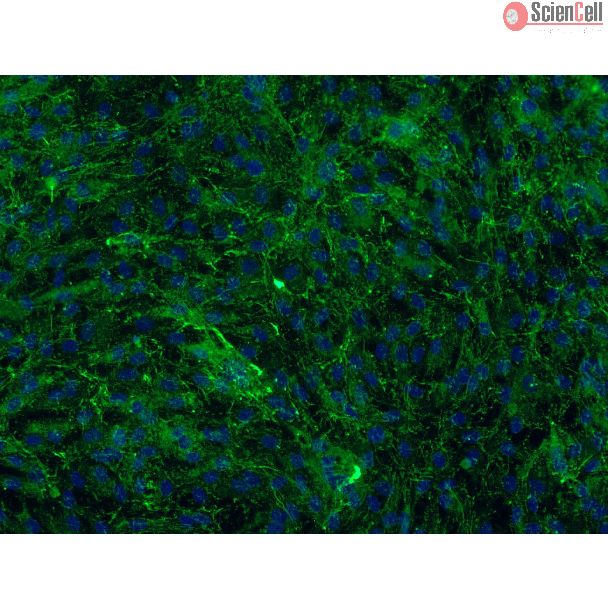 Bovine Meningeal Cells (BMC)-Immunostaining for FN, 200X