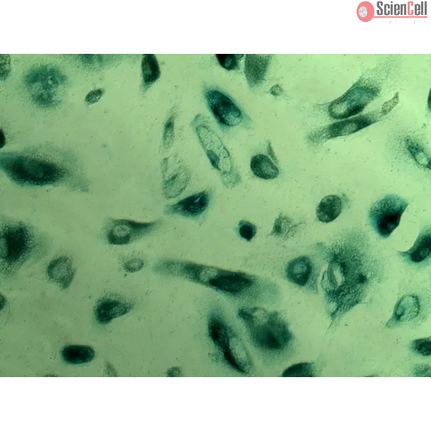 Cell Senescence Assay