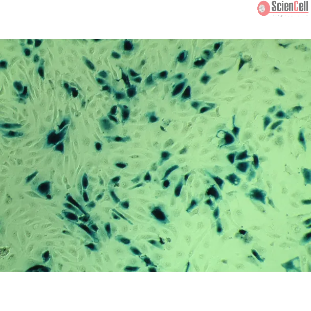 Transfections-EndoF