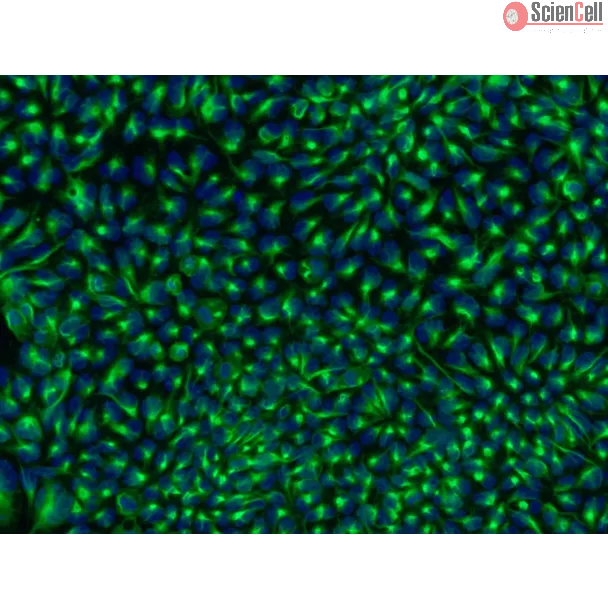 HPSC-Derived Neural Stem Cells (H9-NSC) – Immunostaining for Nestin, 200x
