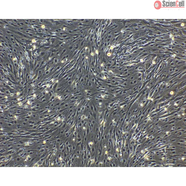 hPSC-Derived Endothelial Cells (hPSC-EC) - Phase contrast, 100x