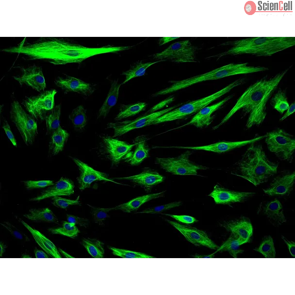 Human Amniotic Epithelial Cells (HAmEpiC) - Immunostaining for CK-18, 200x.
