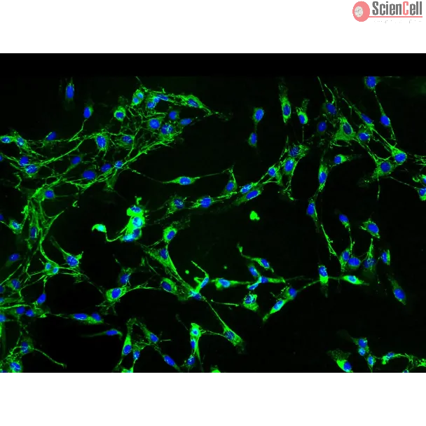 Human Aortic Adventitia Fibroblasts (HAAF) - Immunostaining for Fibronectin, 200x.