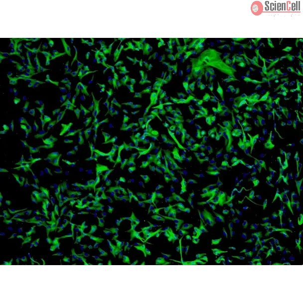 Human Astrocytes-cerebellar (HA-c) - Immunostaining for GFAP, 100x.
