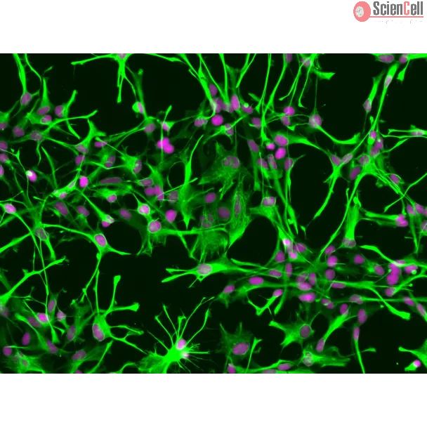 Human Astrocytes (HA) - Immunostaining for GFAP, 200x.
