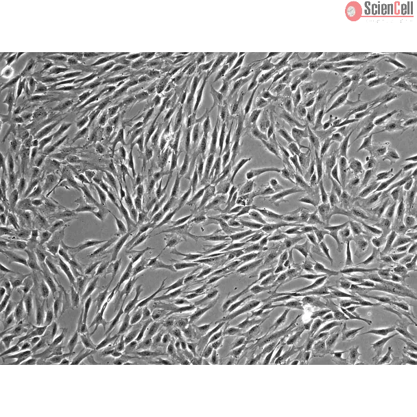 HumanBone Marrow-derived_Mesenchymal_Stem_Cells (HMSC-bm) – Phase contrast, 100x.
