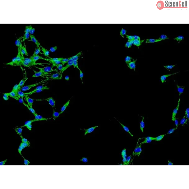 Human Brain Vascular Adventitial Fibroblasts (HBVAF) - Immunostaining for Fibronectin, 200x.
