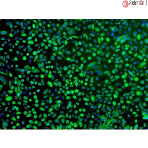 Human Bronchial Epithelial Cells (HBEpiC) - Immunostaining for CK-18, 100x.
