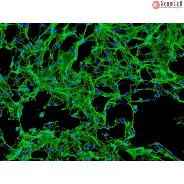 Human Calvarial Osteoblasts (HCO) - Immunostaining for Fibronectin, 200x.
