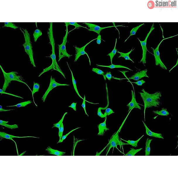 Human Cardiac Fibroblasts-adult (HCF-a) - Immunostaining for Vimentin, 200x.
