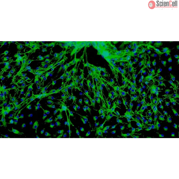 Human Cardiac Fibroblasts-fetal atrial (HCF-fa) - Immunostaining for Fibronectin, 100x.
