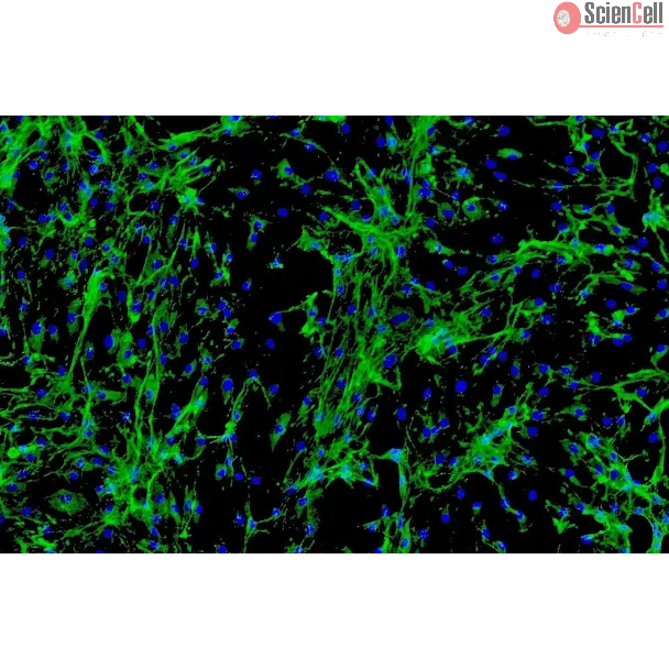 Human Cardiac Fibroblasts-juvenile ventricular (HCF-av) - Immunostaining for Fibronectin, 100x.