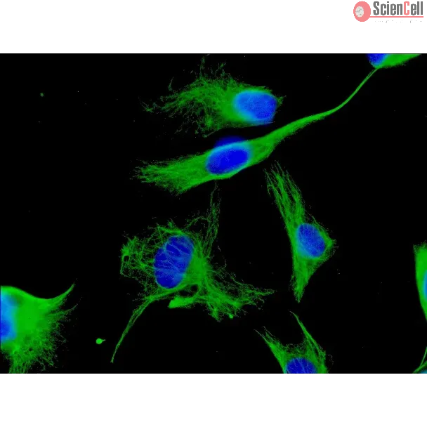 Human Cardiac Fibroblasts (HCF) - Immunostaining for Vimentin, 600x..