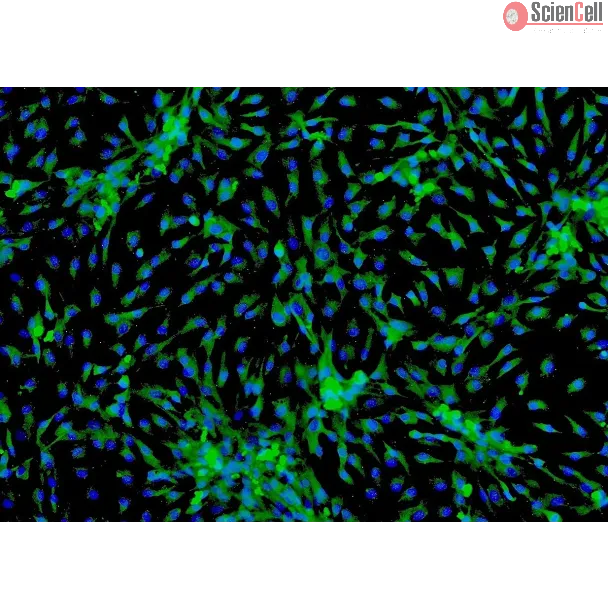 Human Cardiac Myocytes-adult (HCM-a) - Immunostaining for Sarcomeric α-Actinin, 100x.