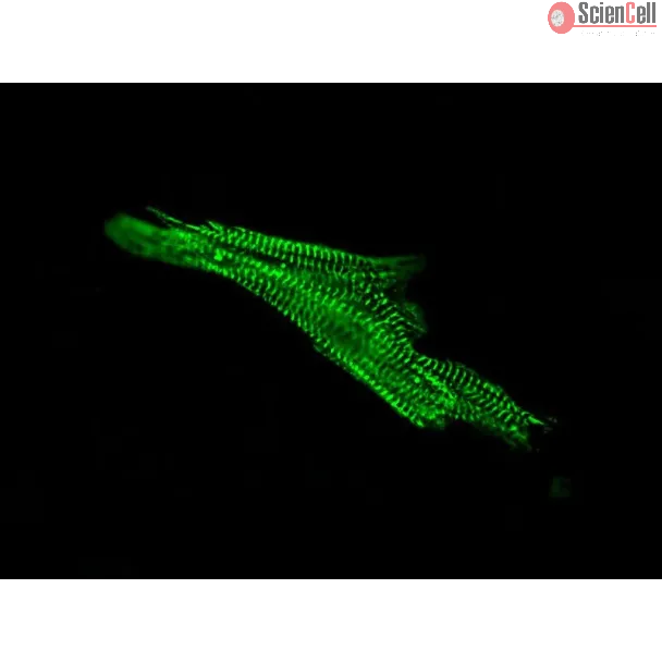 Human Cardiac Myocytes (HCM) – Immunostaining for Sarcomeric alpha-Actinin (Boster, Cat #MA1104)
 
