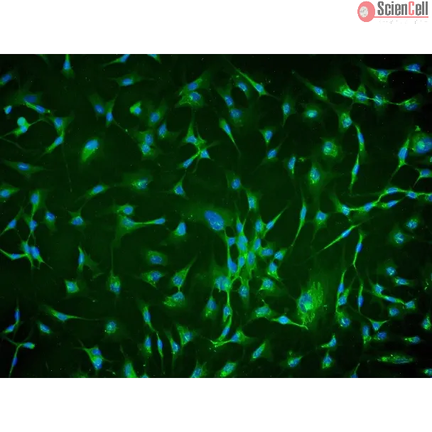 Human Chorionic Mesenchymal Stromal Cells (HCMSC) - Immunostaining for CD105, 200x.
