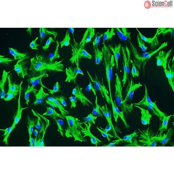 Human Choroid Plexus Epithelial Cells (HCPEpiC) - Immunostaining for CK-18, 200x.

