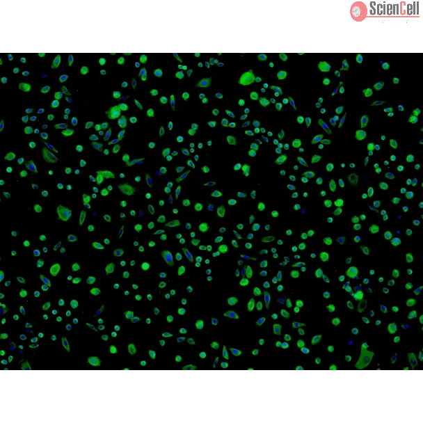 Human Colonic Epithelial Cells (HCoEpiC) - Immunostaining for CK-18, 100x.
