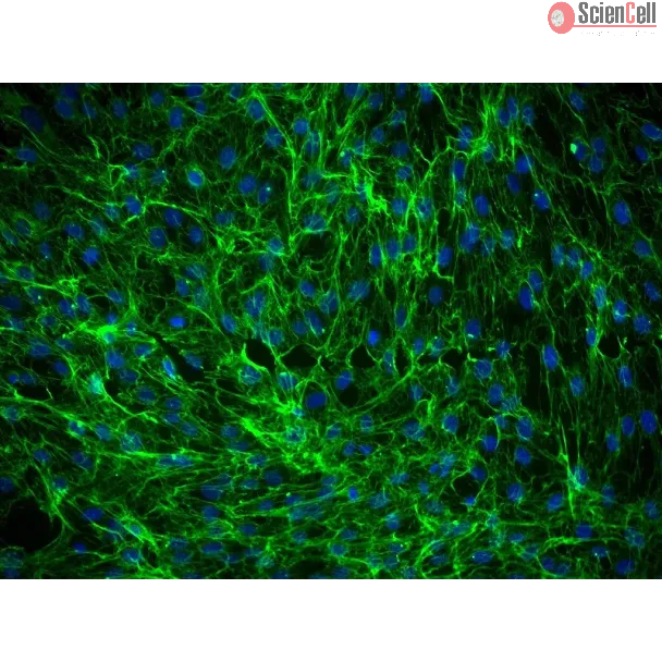 Human Dermal Fibroblasts-fetal (HDF-f) - Immunostaining for Fibronectin, 200x.
