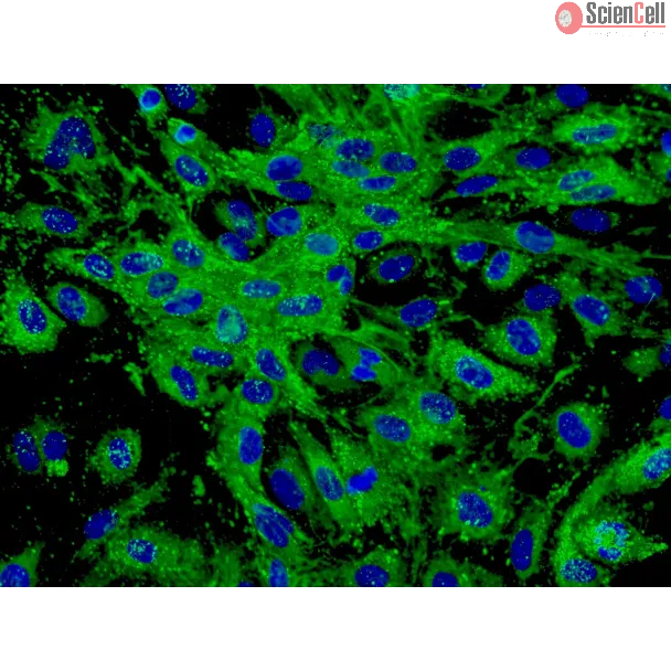 Human Dermal Microvascular Endothelial Cells (HDMEC) - Immunostaining for vWF, 400x.
