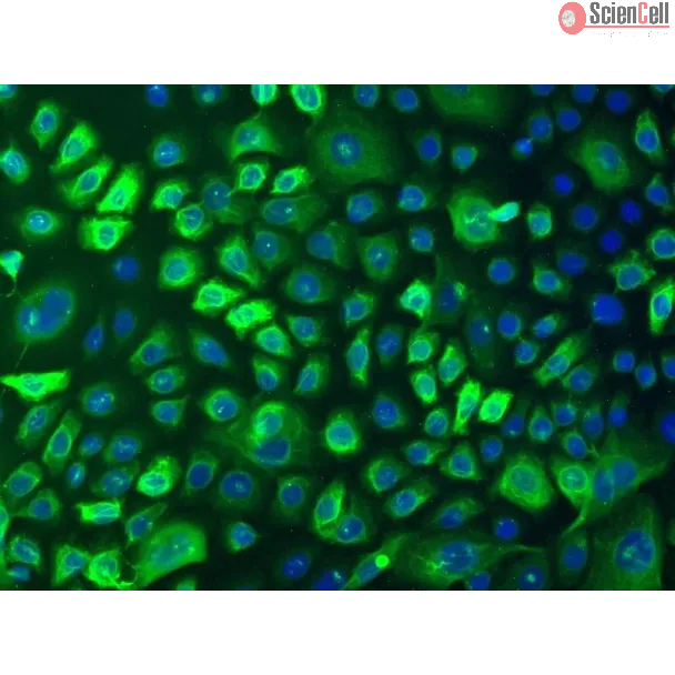 Human Epidermal Keratinocytes-adult (HEK-a) - Immunostaining for CK-18, 100x.
