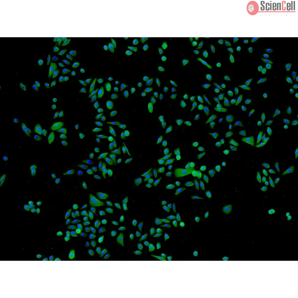 Human Epidermal Keratinocytes-fetal (HEK-f) - Immunostaining for CK-18, 100x.
