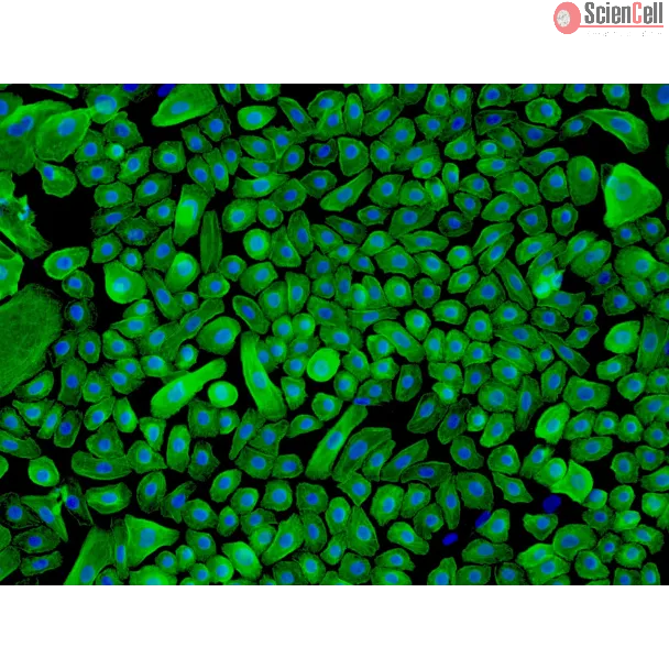 Human Epidermal Keratinocytes-neonatal (HEK-n) - Immunostaining for CK-18, 200x.
