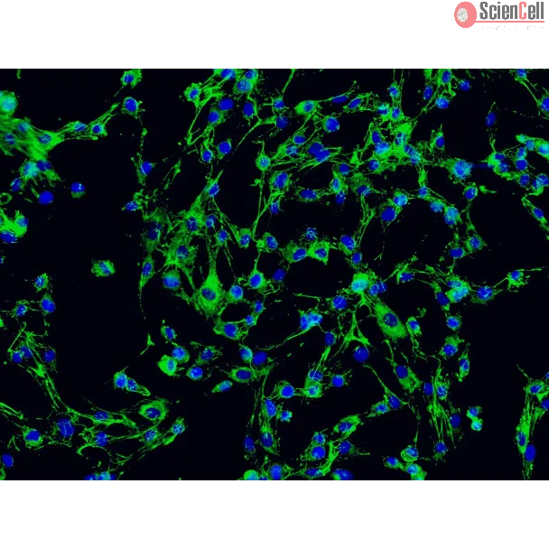 2730 Immunostaining FN 200x

