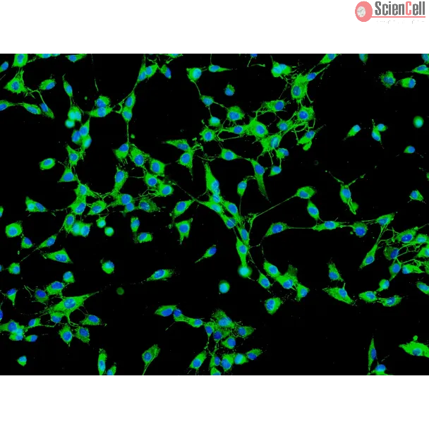 Human Gallbladder Fibroblasts (HGBF) - Immunostaining for Fibronectin, 200x.

