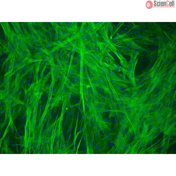 Human Gastric Smooth Muscle Cells (HGSMC) - Immunostaining for α-SMA, 200x.
