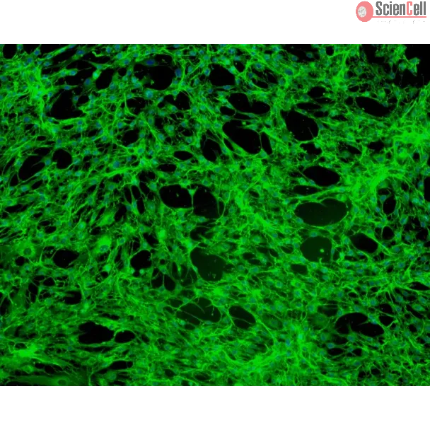 Human Gingival Fibroblasts (HGF) - Immunostaining for Fibronectin, 200x.
