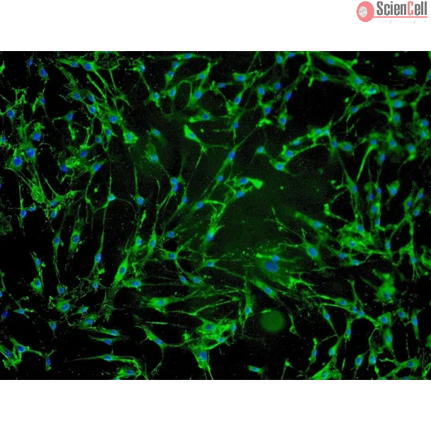 Human Hair Dermal Papilla Cells (HHDPC) - Immunostaining for Fibronectin, 100x.

