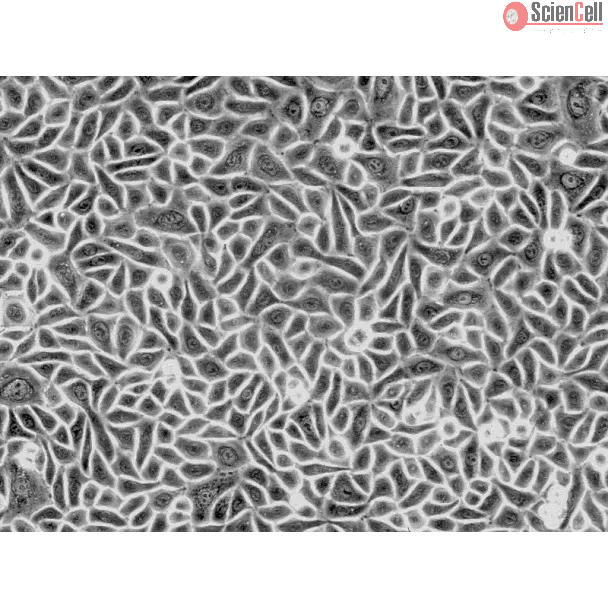 Human Hair Follicular Keratinocytes (HHFK) - Phase contrast, 200x.
