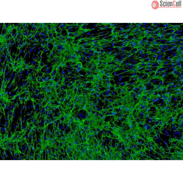 Human Hair Outer Root Sheath Cells (HHORSC) - Immunostaining for Fibronectin, 100x.
