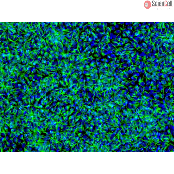 HiPSC-Derived Neural Stem Cells (HiPSC-NSC) - Immunostaining for Nestin, 200x
