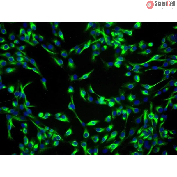 Human Lens Epithelial Cells (HLEpiC) - Immunostaining for CK-19, 200x.

